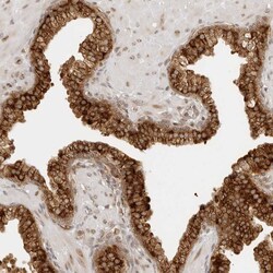 Invitrogen eIF4G Polyclonal Antibody 100 &mu;L; Unconjugated:Antibodies,