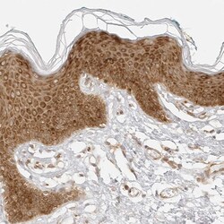Invitrogen eIF4G Polyclonal Antibody 100 &mu;L; Unconjugated:Antibodies,