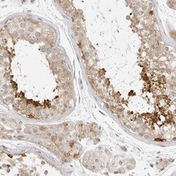 Invitrogen eIF4G Polyclonal Antibody 100 &mu;L; Unconjugated:Antibodies,