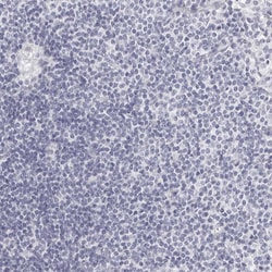 Invitrogen Carbonic Anhydrase VI Polyclonal Antibody 100 &mu;L; Unconjugated:Antibodies,