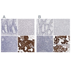 Invitrogen Carbonic Anhydrase VI Polyclonal Antibody 100 &mu;L; Unconjugated:Antibodies,