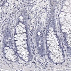 Invitrogen Carbonic Anhydrase VI Polyclonal Antibody 100 &mu;L; Unconjugated:Antibodies,