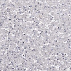 Invitrogen Carbonic Anhydrase VI Polyclonal Antibody 100 &mu;L; Unconjugated:Antibodies,