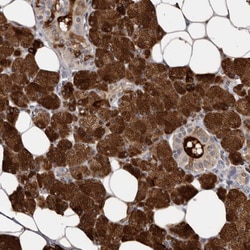 Invitrogen Carbonic Anhydrase VI Polyclonal Antibody 100 &mu;L; Unconjugated:Antibodies,