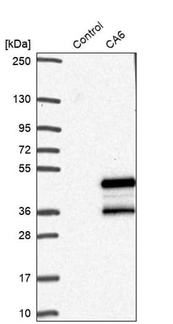 Invitrogen Carbonic Anhydrase VI Polyclonal Antibody 100 &mu;L; Unconjugated:Antibodies,