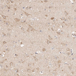 HK2 Polyclonal Antibody:Antibodies, Polyclonal