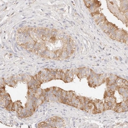HK2 Polyclonal Antibody:Antibodies, Polyclonal