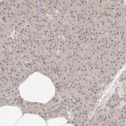 HK2 Polyclonal Antibody:Antibodies, Polyclonal