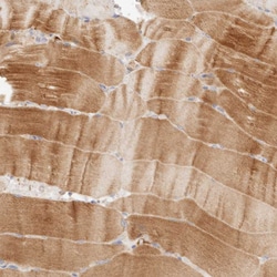 HK2 Polyclonal Antibody:Antibodies, Polyclonal
