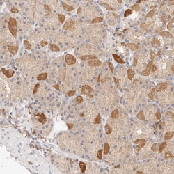 HK2 Polyclonal Antibody:Antibodies, Polyclonal