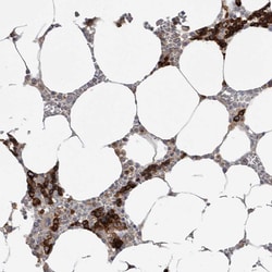 Invitrogen Transferrin Receptor Polyclonal Antibody 100 &mu;L; Unconjugated:Antibodies,