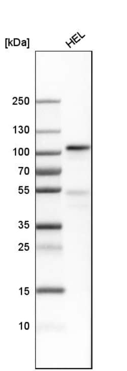 Invitrogen Transferrin Receptor Polyclonal Antibody 100 &mu;L; Unconjugated:Antibodies,