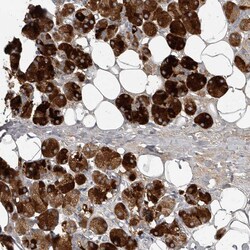 Invitrogen Carbonic Anhydrase VI Polyclonal Antibody 100 &mu;L; Unconjugated:Antibodies,