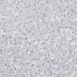 Invitrogen Carbonic Anhydrase VI Polyclonal Antibody 100 &mu;L; Unconjugated:Antibodies,