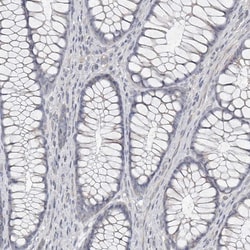 Invitrogen Carbonic Anhydrase VI Polyclonal Antibody 100 &mu;L; Unconjugated:Antibodies,