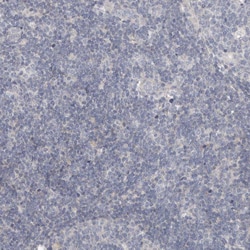 Invitrogen Carbonic Anhydrase VI Polyclonal Antibody 100 &mu;L; Unconjugated:Antibodies,