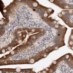 Invitrogen MOGAT2 Polyclonal Antibody 100 &mu;L; Unconjugated:Antibodies,