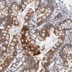 Invitrogen MOGAT2 Polyclonal Antibody 100 &mu;L; Unconjugated:Antibodies,