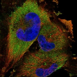 Invitrogen HIP2 Polyclonal Antibody 100 &mu;L; Unconjugated:Antibodies,
