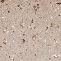 Invitrogen HIP2 Polyclonal Antibody 100 &mu;L; Unconjugated:Antibodies,