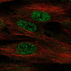 Invitrogen FOXF1 Polyclonal Antibody 100 &mu;L; Unconjugated:Antibodies,