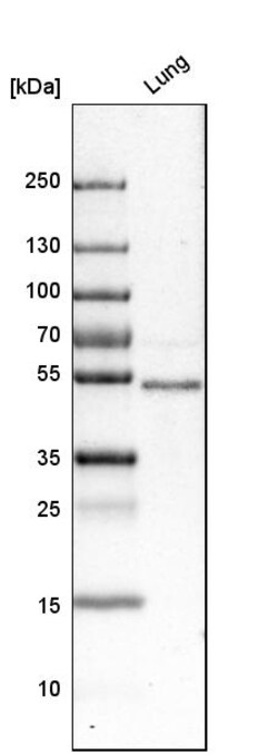 Invitrogen FOXF1 Polyclonal Antibody 100 &mu;L; Unconjugated:Antibodies,