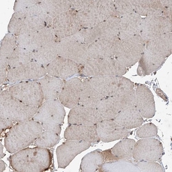 Invitrogen HOXC8 Polyclonal Antibody 100 &mu;L; Unconjugated:Antibodies,