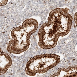 Invitrogen RNASET2 Polyclonal Antibody 100 &mu;L; Unconjugated:Antibodies,