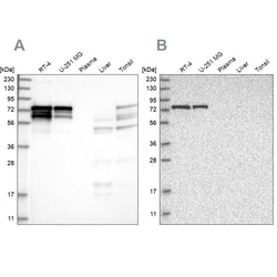 Invitrogen PPP2R5D Polyclonal Antibody 100 &mu;L | Buy Online | Invitrogen&trade; | Fisher Scientific