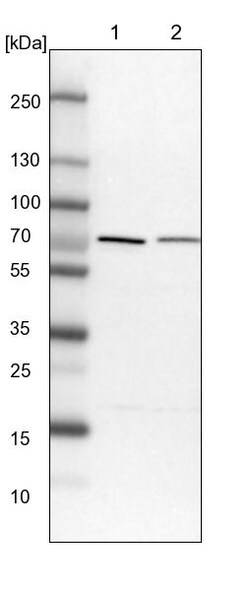 Invitrogen PPP2R5D Polyclonal Antibody 100 &mu;L | Buy Online | Invitrogen&trade; | Fisher Scientific