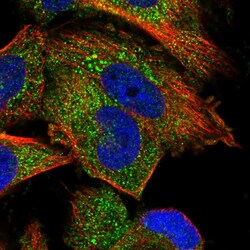 Invitrogen PP5 Polyclonal Antibody 100 &mu;L; Unconjugated:Antibodies,