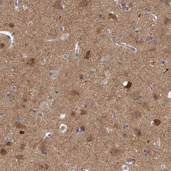 Invitrogen PP5 Polyclonal Antibody 100 &mu;L; Unconjugated:Antibodies,
