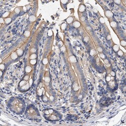 Invitrogen PP5 Polyclonal Antibody 100 &mu;L; Unconjugated:Antibodies,