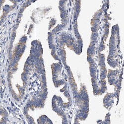 Invitrogen PP5 Polyclonal Antibody 100 &mu;L; Unconjugated:Antibodies,