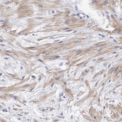Invitrogen PP5 Polyclonal Antibody 100 &mu;L; Unconjugated:Antibodies,