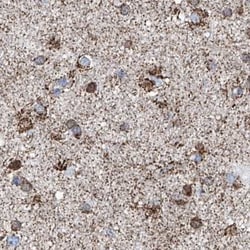 Invitrogen ALDH6A1 Polyclonal Antibody 100 &mu;L; Unconjugated:Antibodies,