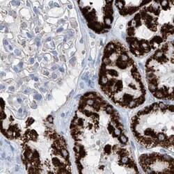 Invitrogen ALDH6A1 Polyclonal Antibody 100 &mu;L; Unconjugated:Antibodies,
