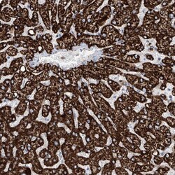 Invitrogen ALDH6A1 Polyclonal Antibody 100 &mu;L; Unconjugated:Antibodies,