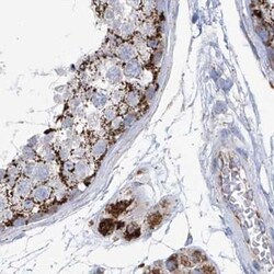 Invitrogen ALDH6A1 Polyclonal Antibody 100 &mu;L; Unconjugated:Antibodies,