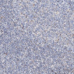 Invitrogen ALDH6A1 Polyclonal Antibody 100 &mu;L; Unconjugated:Antibodies,
