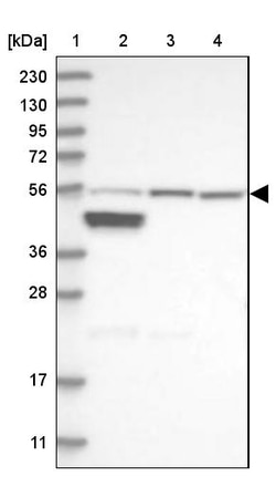 Invitrogen ALDH6A1 Polyclonal Antibody 100 &mu;L; Unconjugated:Anticorps,