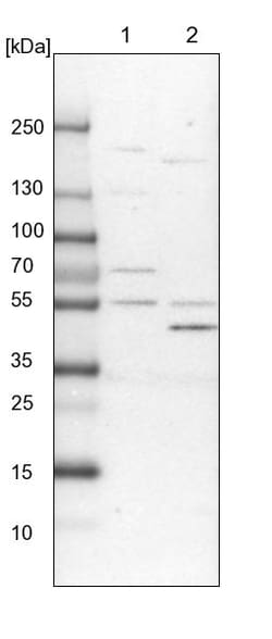 Invitrogen ALDH6A1 Polyclonal Antibody 100 &mu;L; Unconjugated:Anticorps,