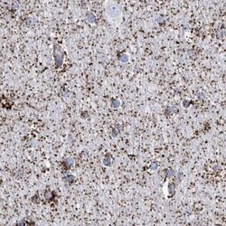 Invitrogen ALDH6A1 Polyclonal Antibody 100 &mu;L; Unconjugated:Antibodies,