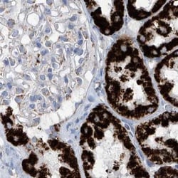 Invitrogen ALDH6A1 Polyclonal Antibody 100 &mu;L; Unconjugated:Antibodies,