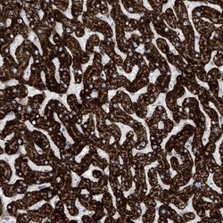 Invitrogen ALDH6A1 Polyclonal Antibody 100 &mu;L; Unconjugated:Antibodies,