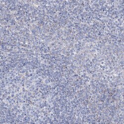 Invitrogen ALDH6A1 Polyclonal Antibody 100 &mu;L; Unconjugated:Antibodies,
