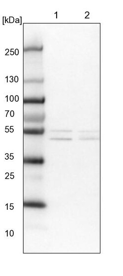 Invitrogen ALDH6A1 Polyclonal Antibody 100 &mu;L; Unconjugated:Antibodies,