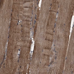 Invitrogen MAPKAP1 Polyclonal Antibody 100 &mu;L; Unconjugated:Antibodies,