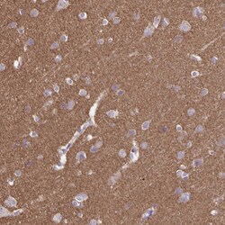 Invitrogen SEPT5 Polyclonal Antibody 100 &mu;L; Unconjugated:Antibodies,