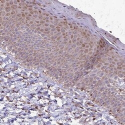 Invitrogen SEPT5 Polyclonal Antibody 100 &mu;L; Unconjugated:Antibodies,